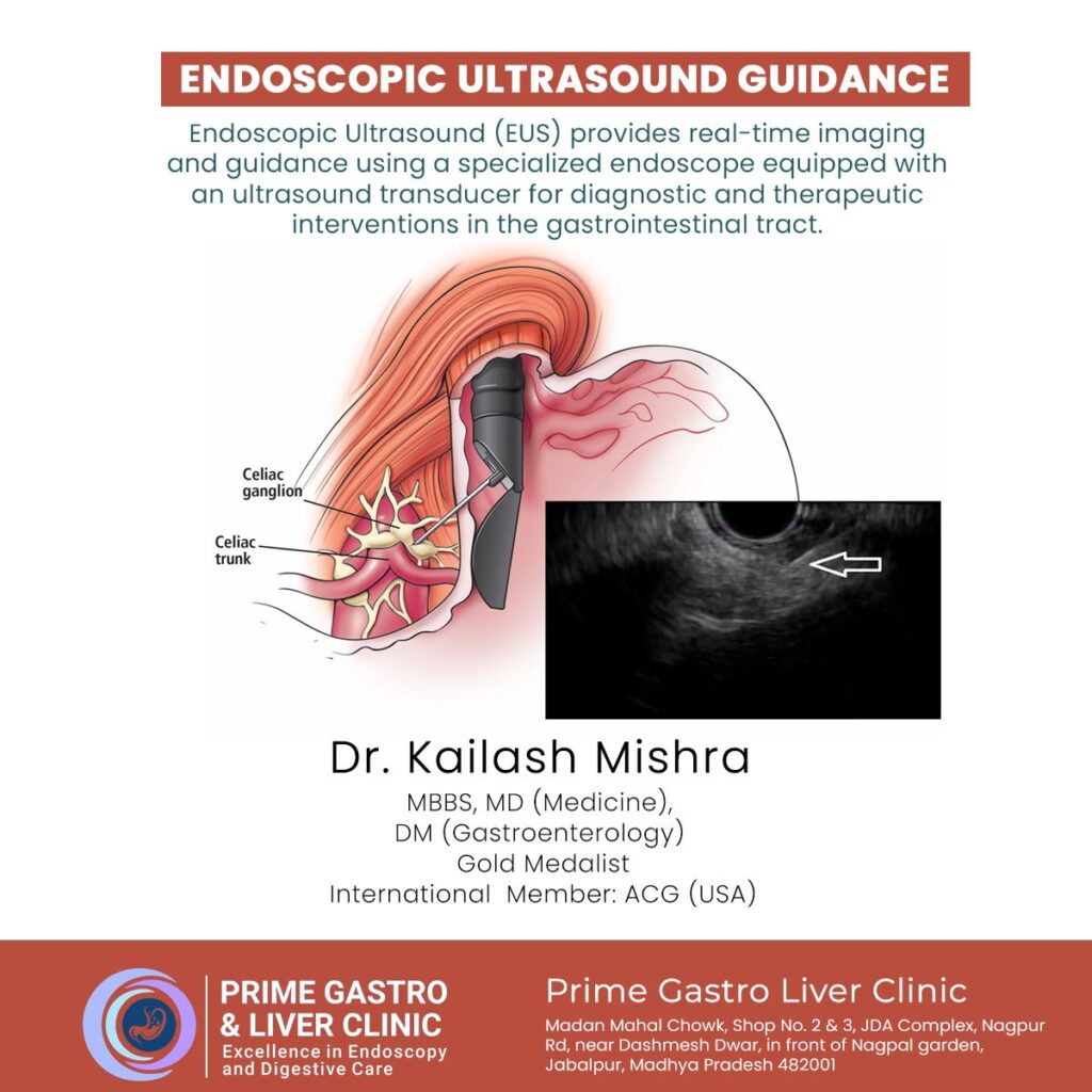 Endoscopic Ultrasound Guidance Advantages More