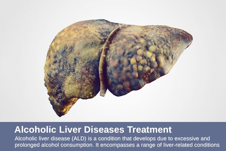 Alcoholic Liver Diseases Treatment - Prime Gastro Liver Clinic