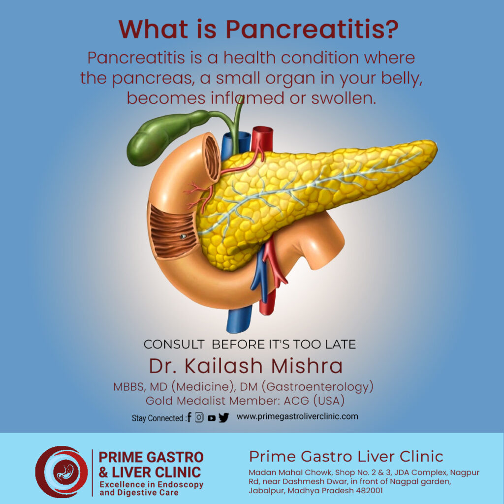 What is Pancreatitis?, Symptoms, Causes, Treatment & More