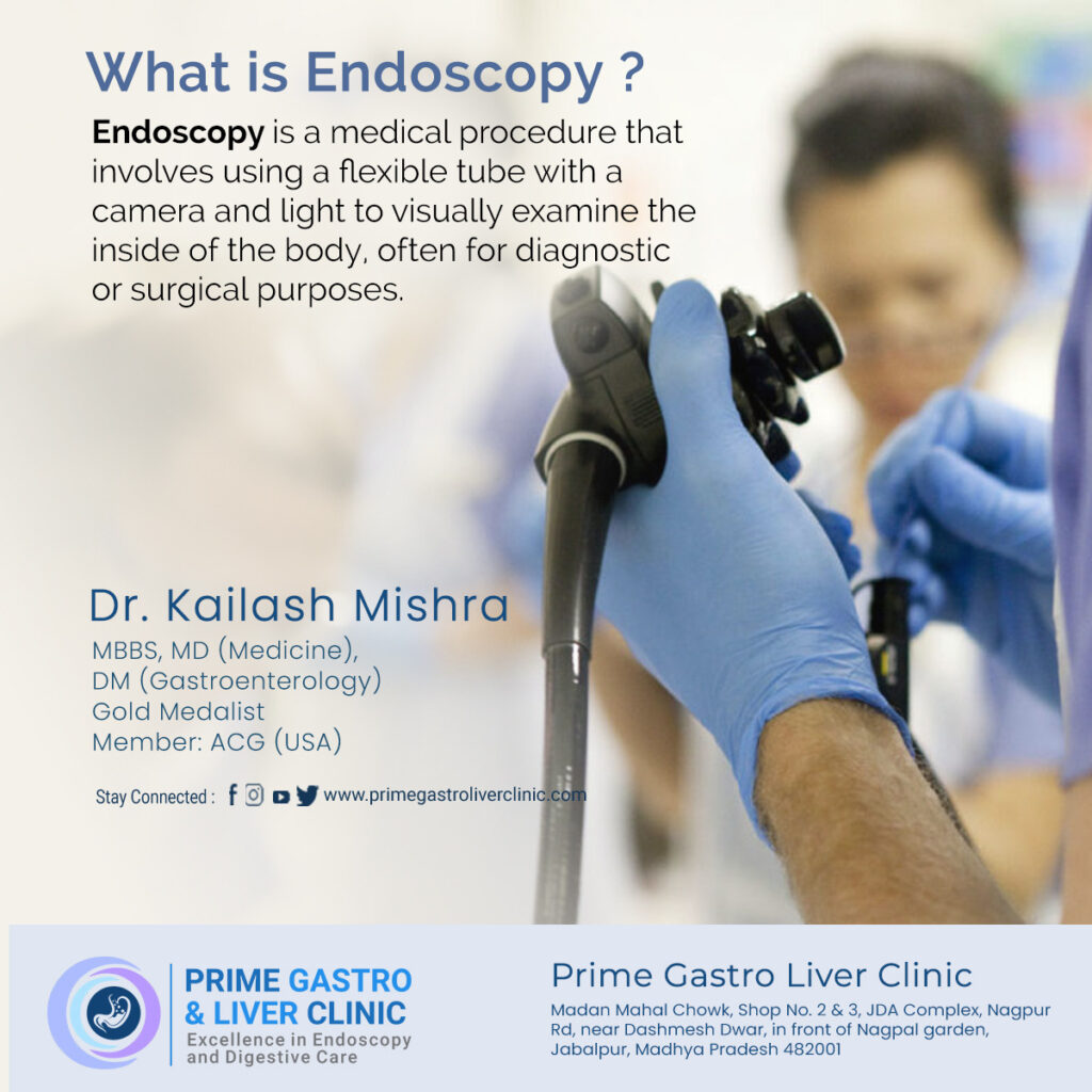 What is Endoscopy, Define, Types, Use & More Prime Gastro Liver Clinic