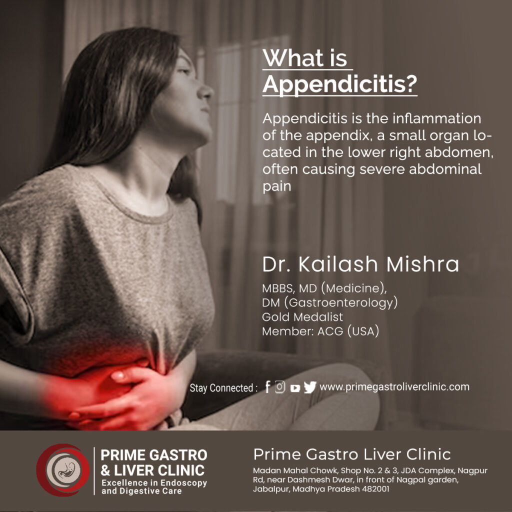 What is Appendicitis?, Symptoms, Causes, Treatment & More