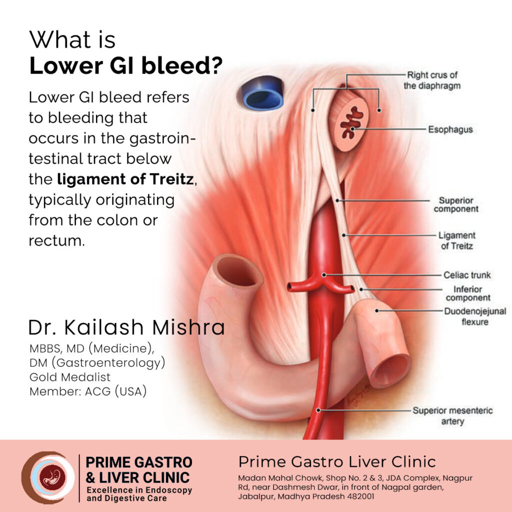 What Is Lower Gi